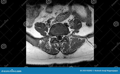 magnetic resonance imaging problems